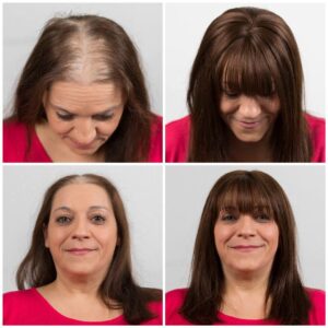Echthaarteil Vorher / Nachher © Haircontrast